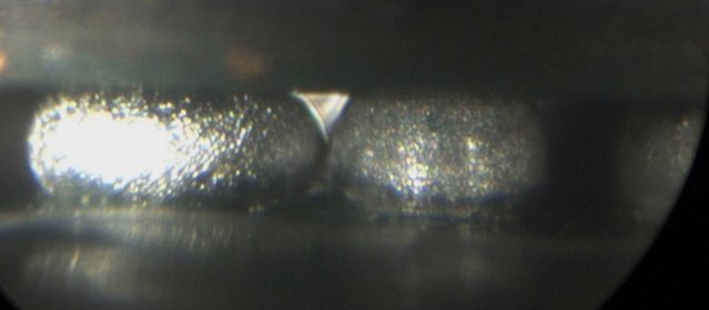 Picture 03: Recording a BGA connection with too large a diameter with ERSASCOPE inspection system